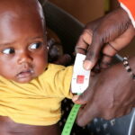 何百万人もの子どもたちが急性栄養不良で命の危険： 国連機関が緊急支援を呼びかけ